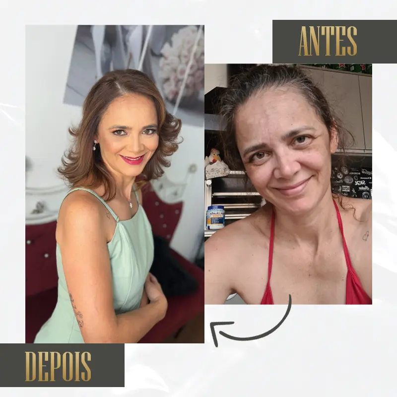 foto antes e depois